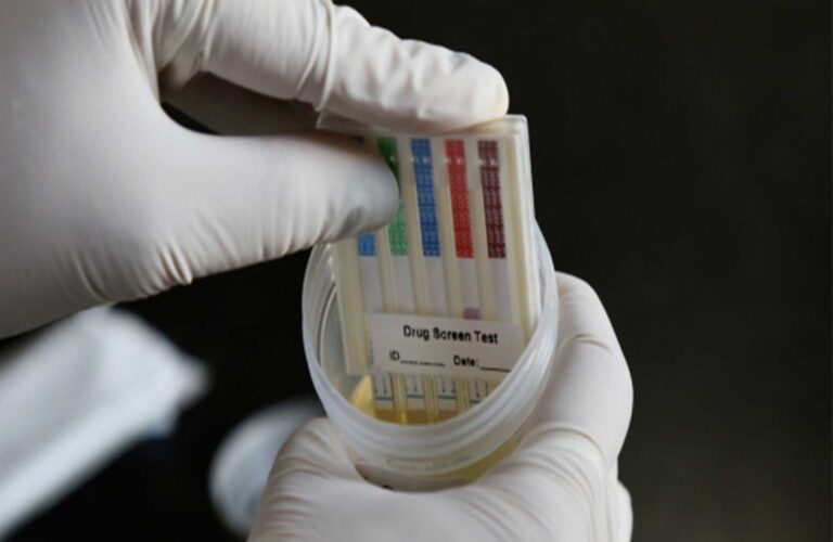 prueba antidoping en laboratorio