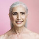 Mujer con fotoenvejecimiento y manchas